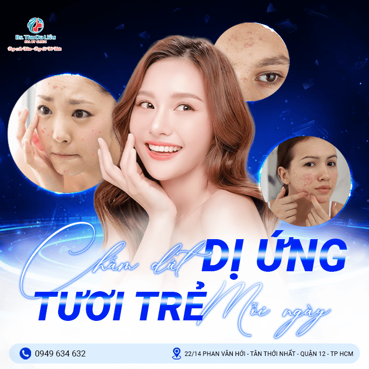Điều trị da dị ứng quận 12, cần lưu ý gì?
