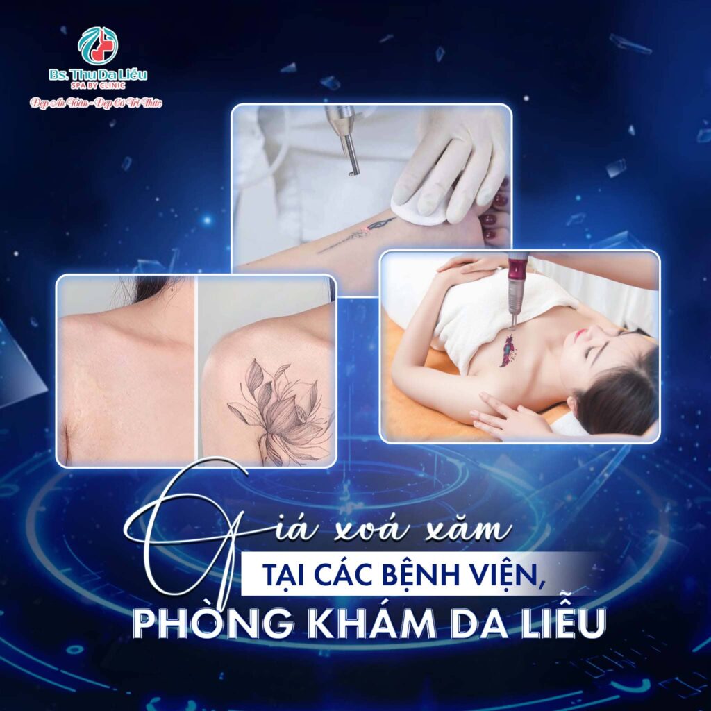 Giá xoá xăm ở Bệnh viện, Phòng da liễu