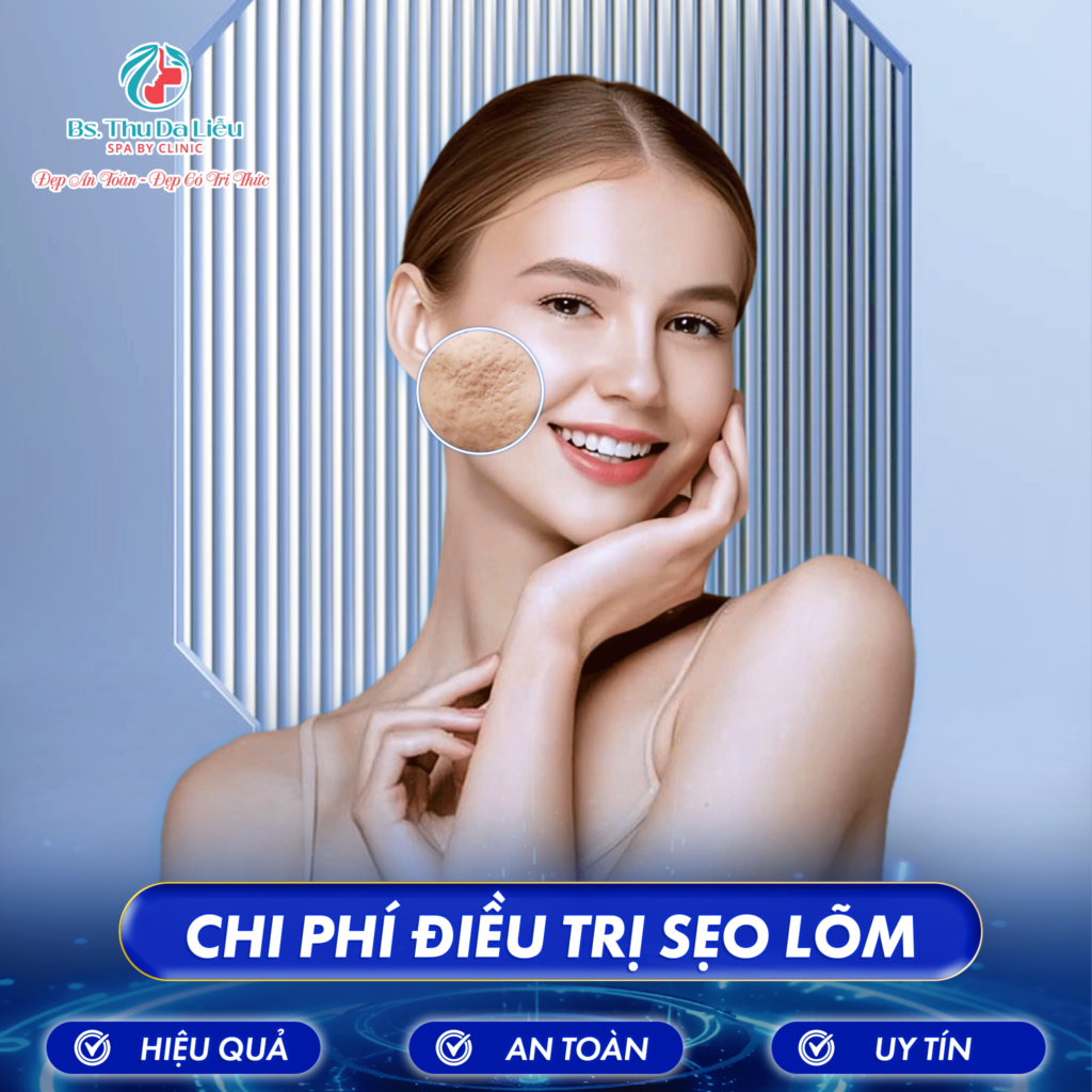 Chi phí điều trị Sẹo lõm bao nhiêu?