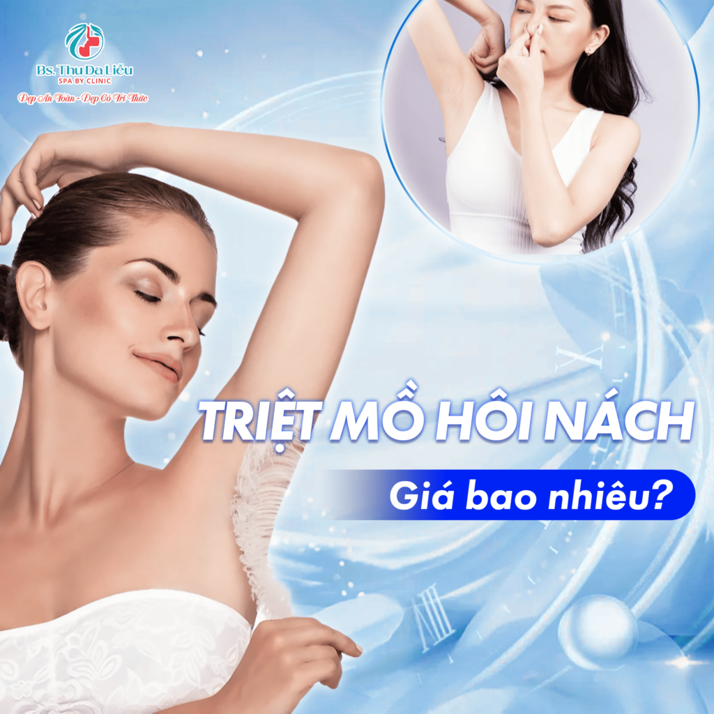 Triệt mồ hôi nách giá bao nhiêu?