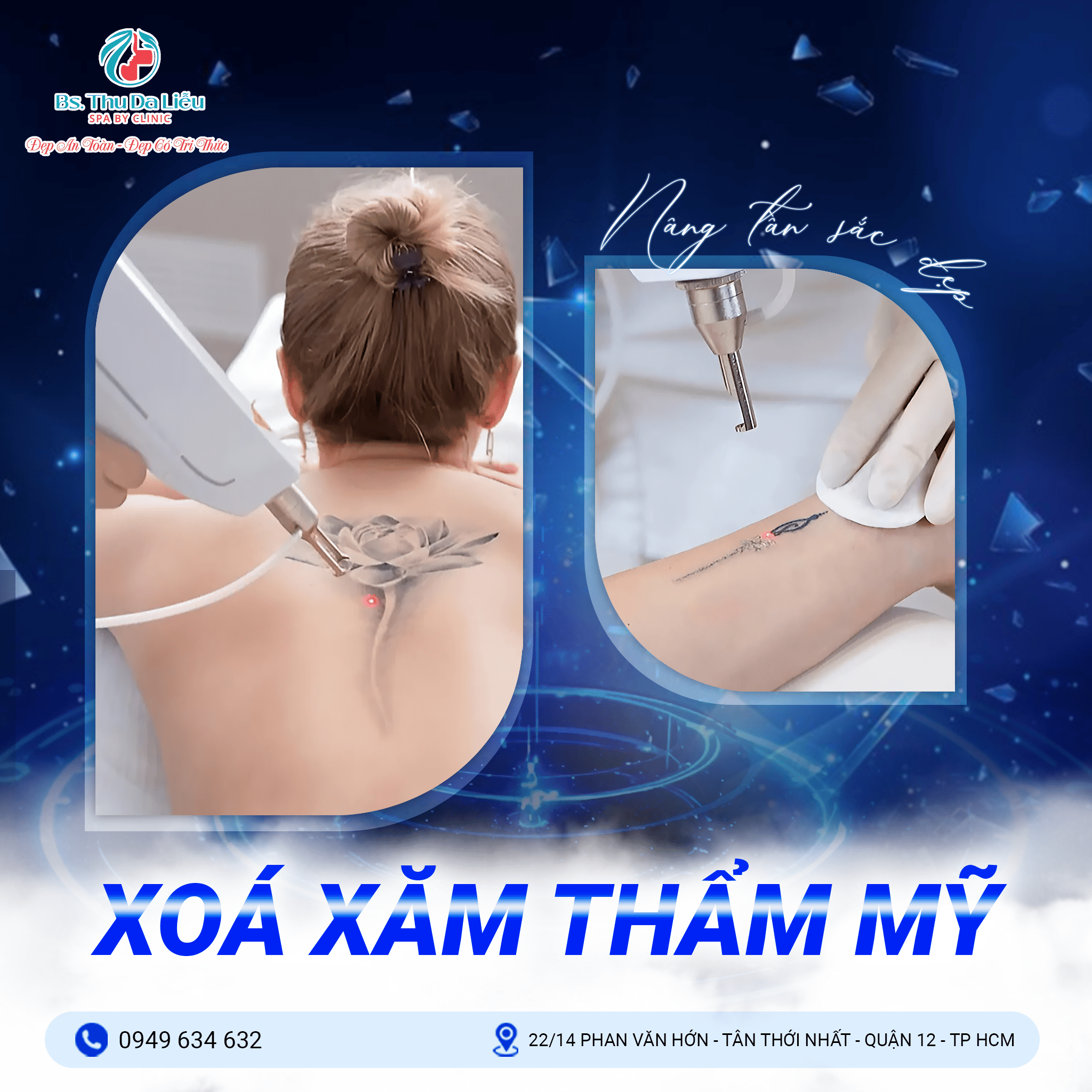Giá xoá xăm ở Bệnh viện, Phòng da liễu 