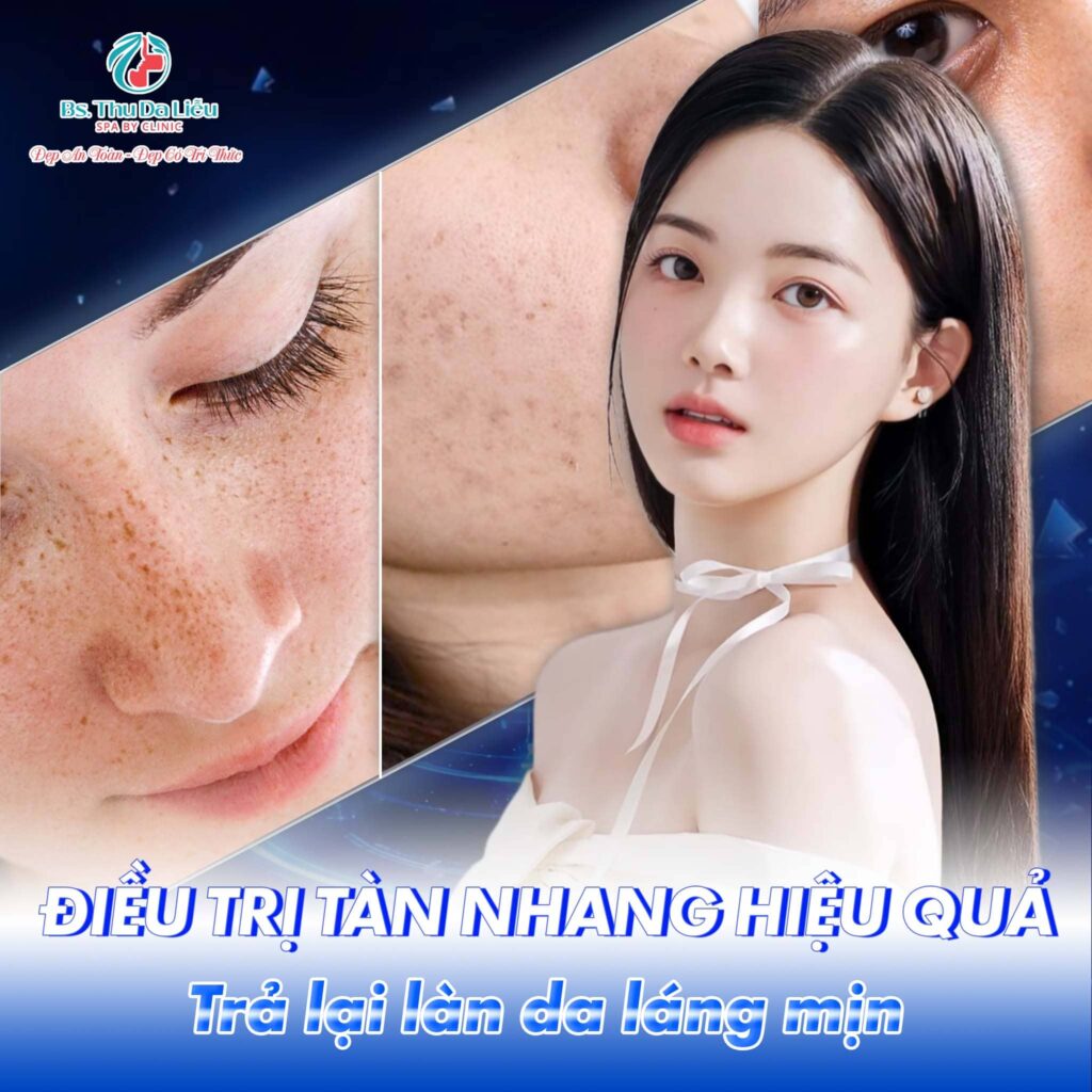 Điều trị tàn nhang hiệu quả