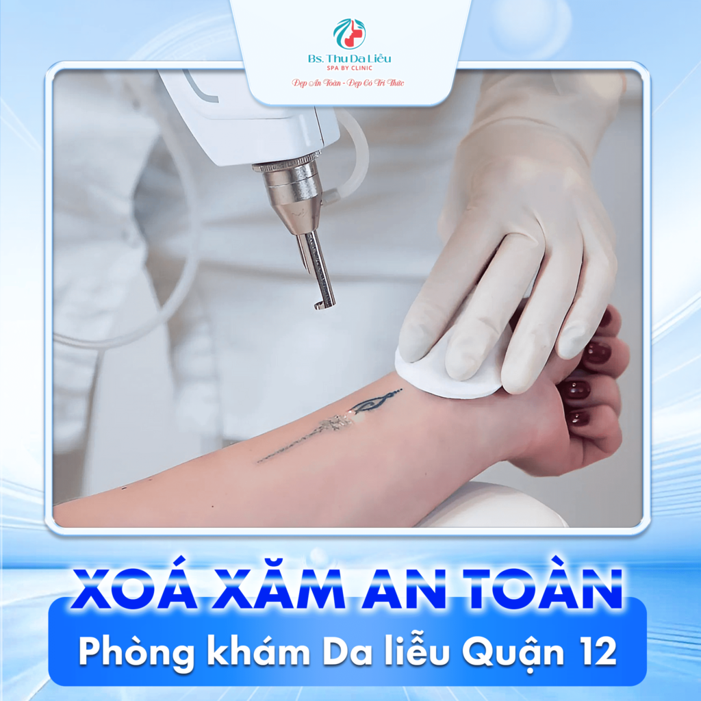 Phòng khám Da liễu Quận 12: Giá xoá xăm