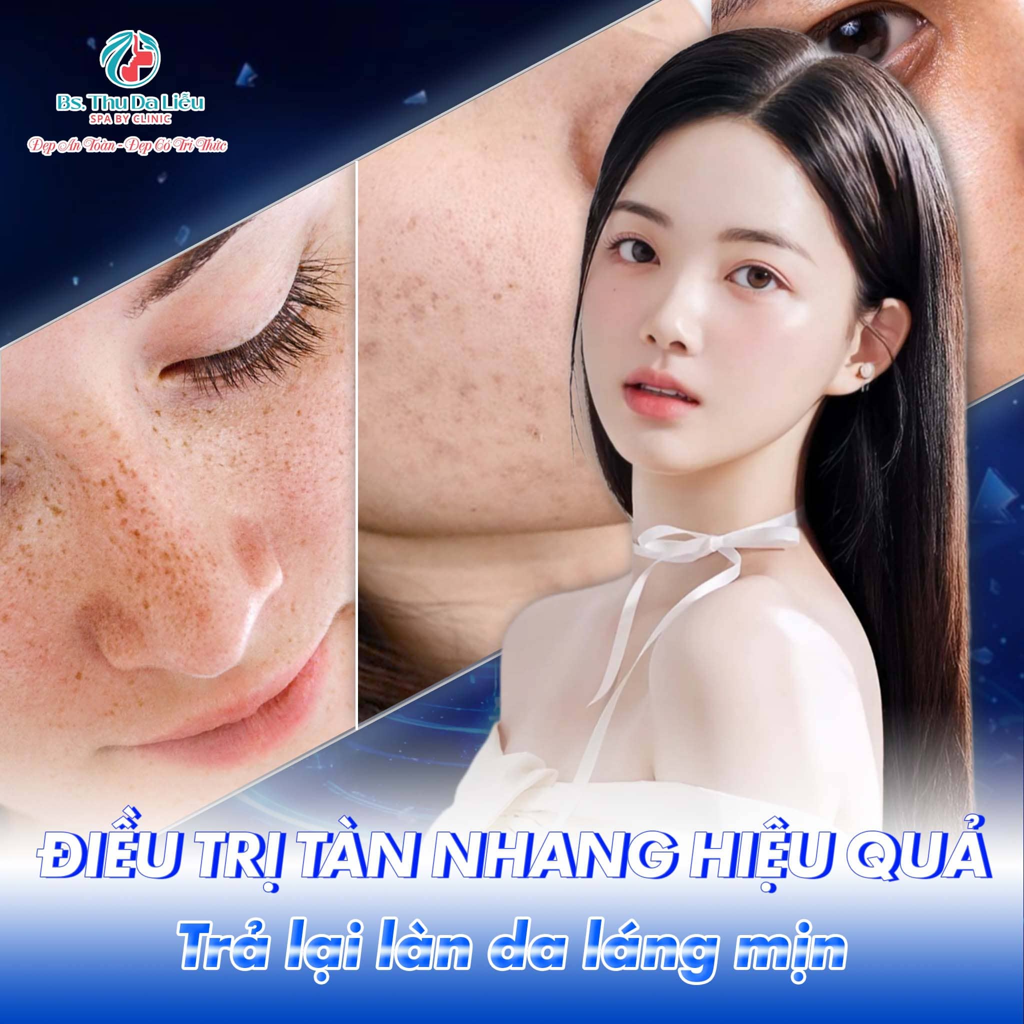 Điều trị tàn nhang kiêng ăn gì?
