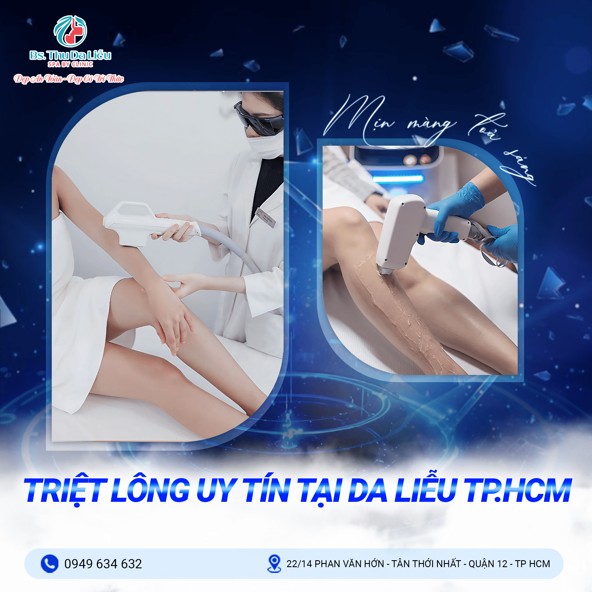 Điều trị nám bằng công nghệ Laser