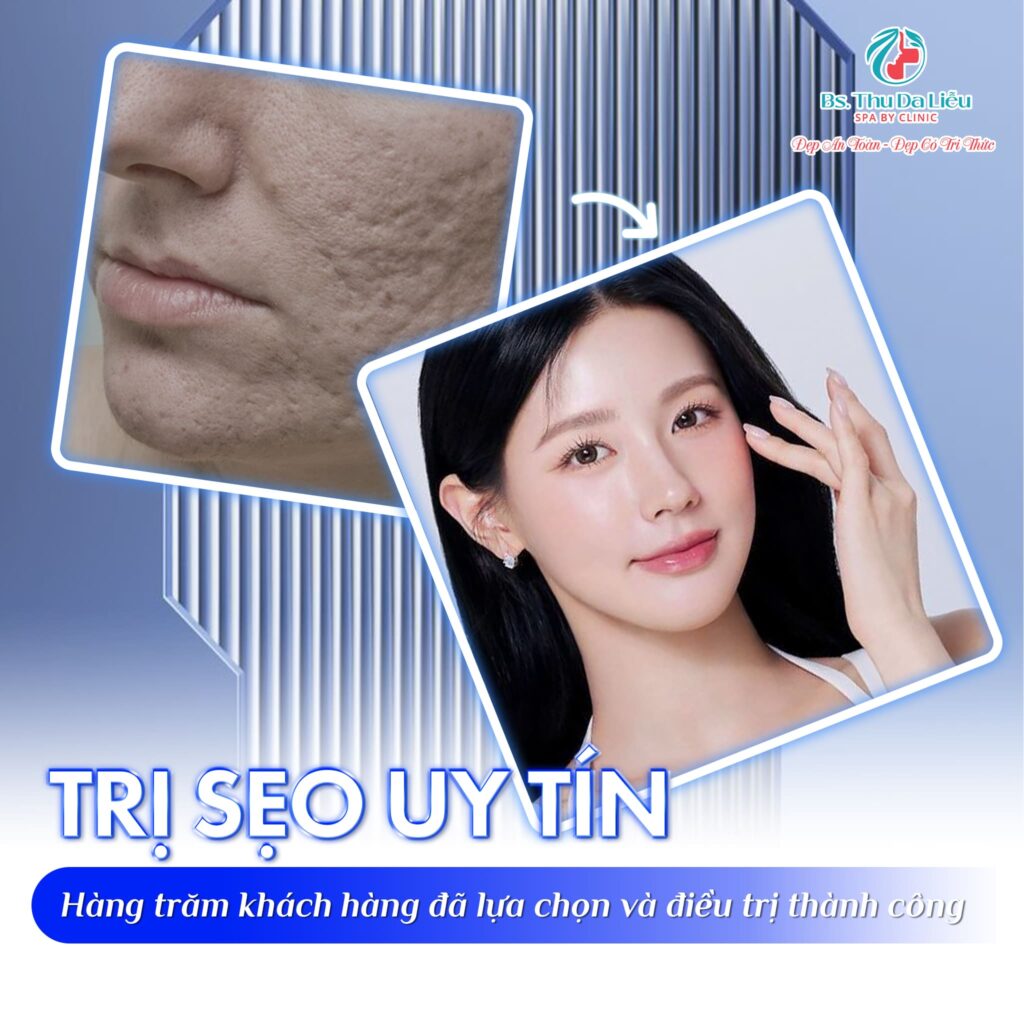 Trị sẹo uy tín TP.HCM