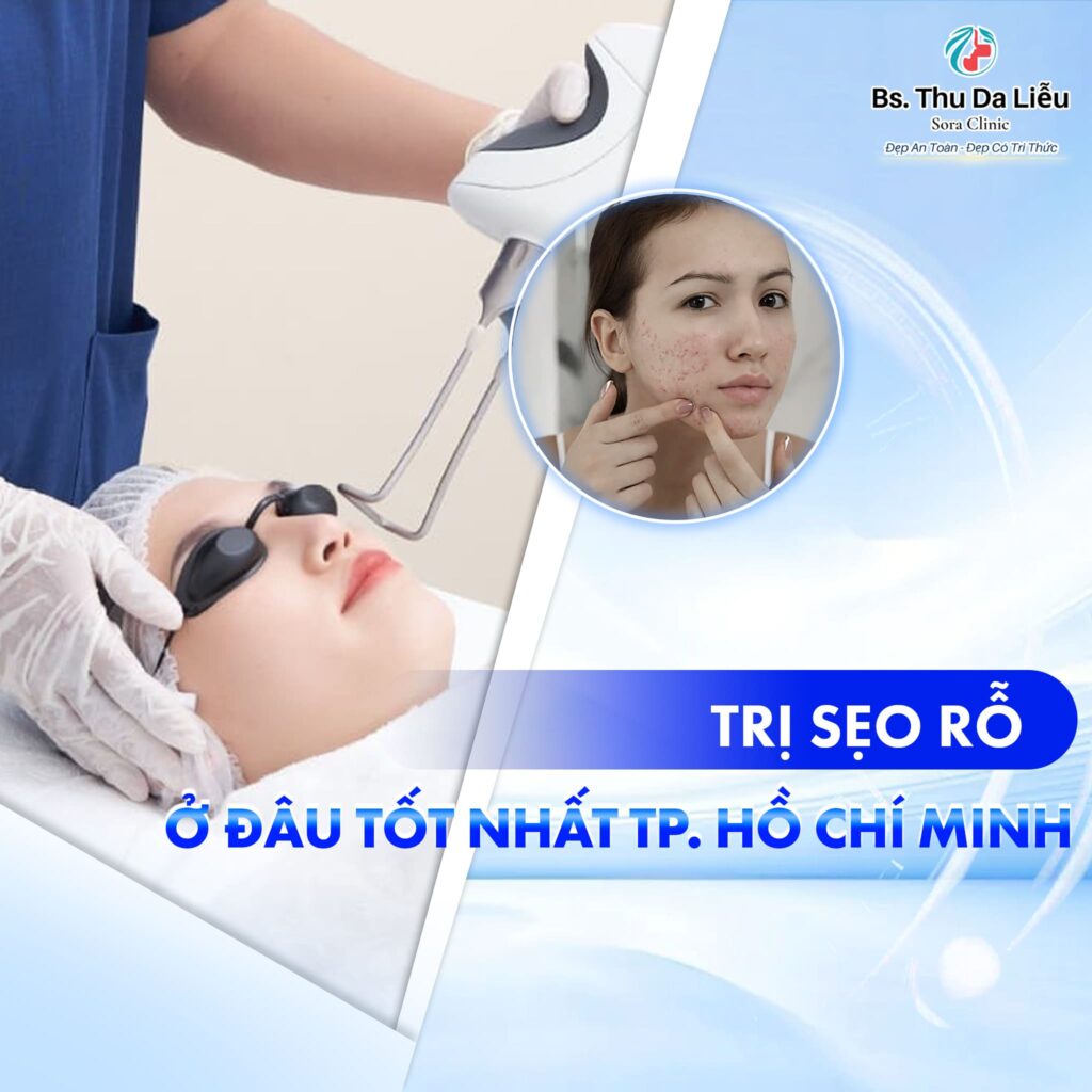 Trị Sẹo rỗ ở đâu tốt nhất TP.HCM