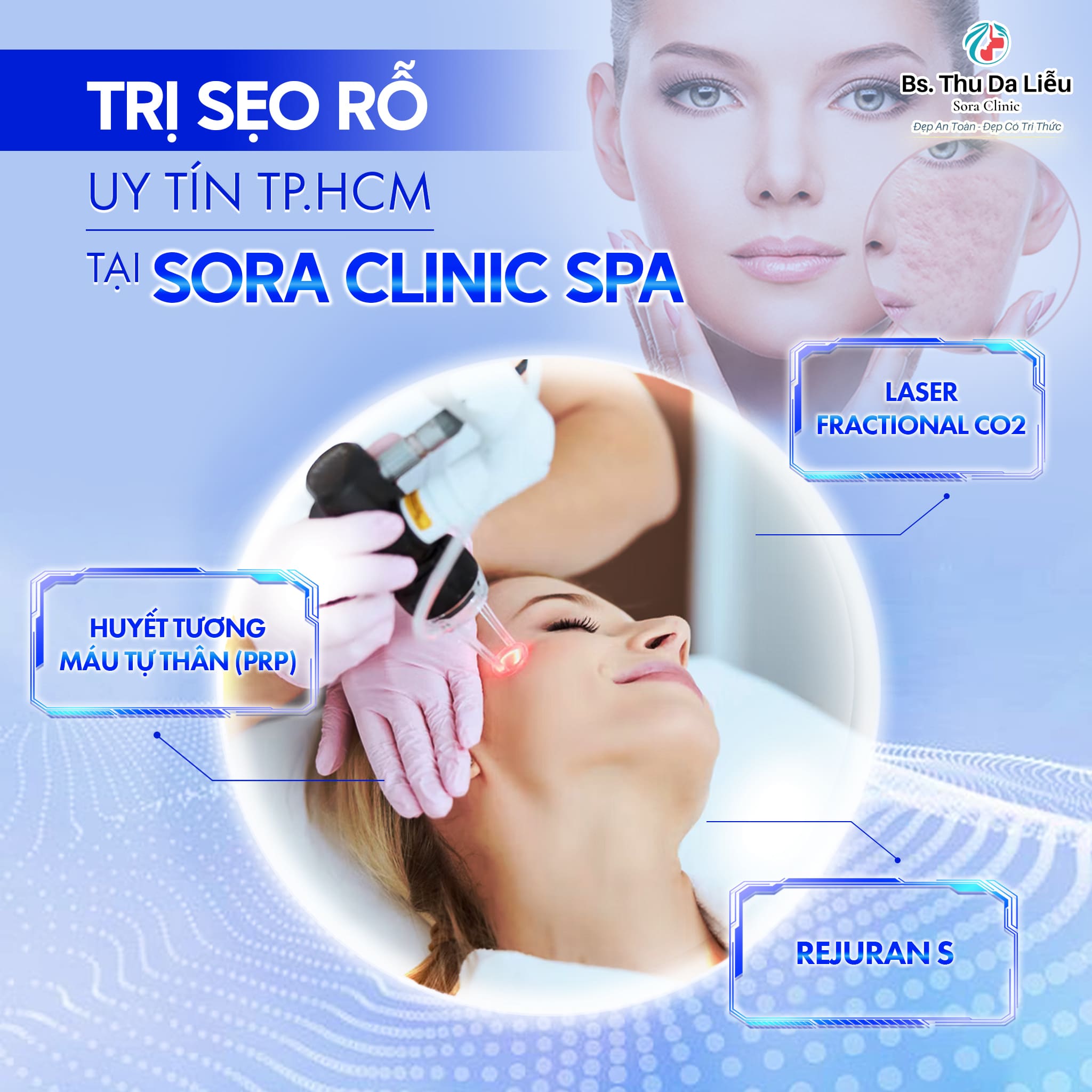 Nơi điều trị Sẹo rỗ uy tín tại TP.HCM