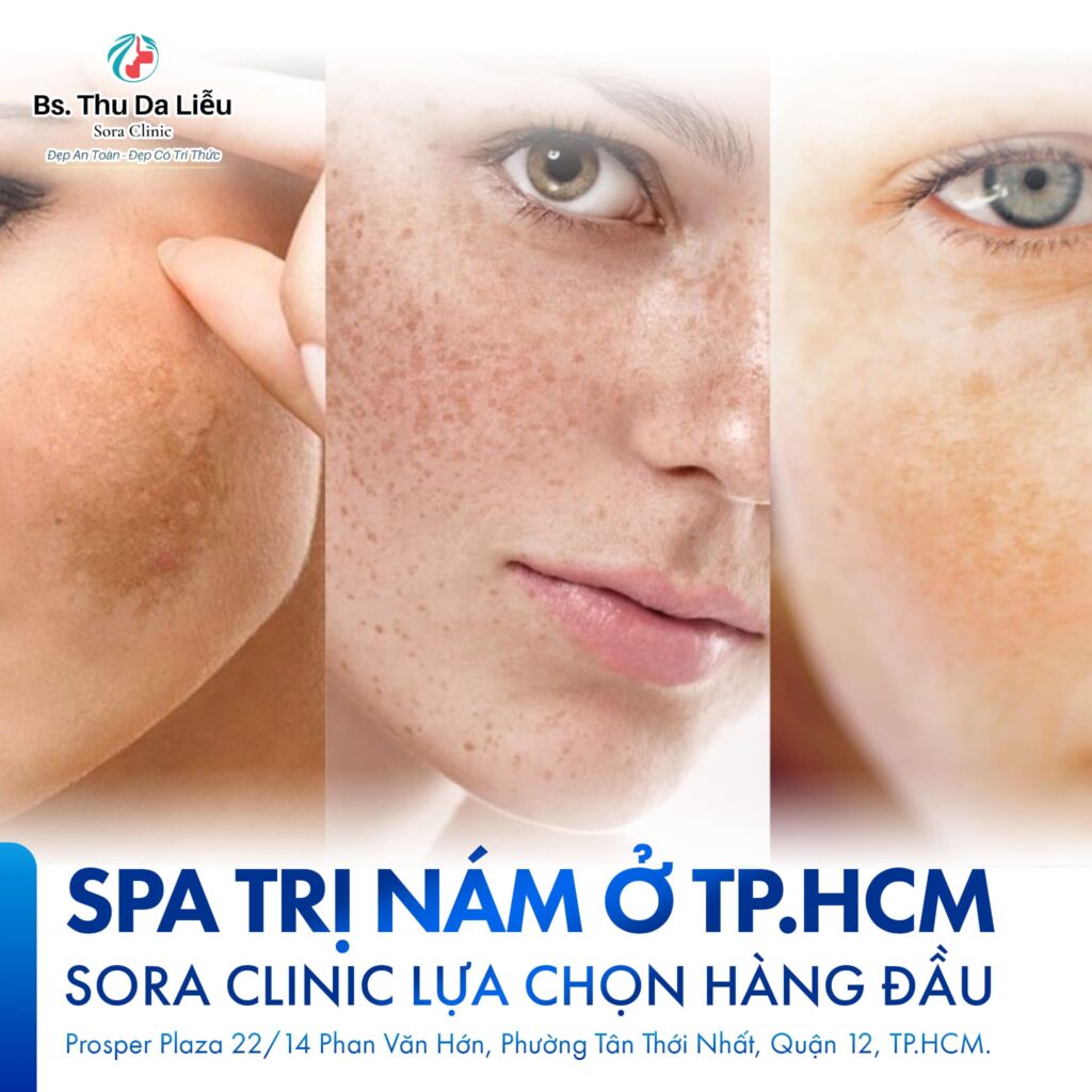 Spa trị nám ở TP.HCM: Sora Clinic lựa chọn hàng đầu