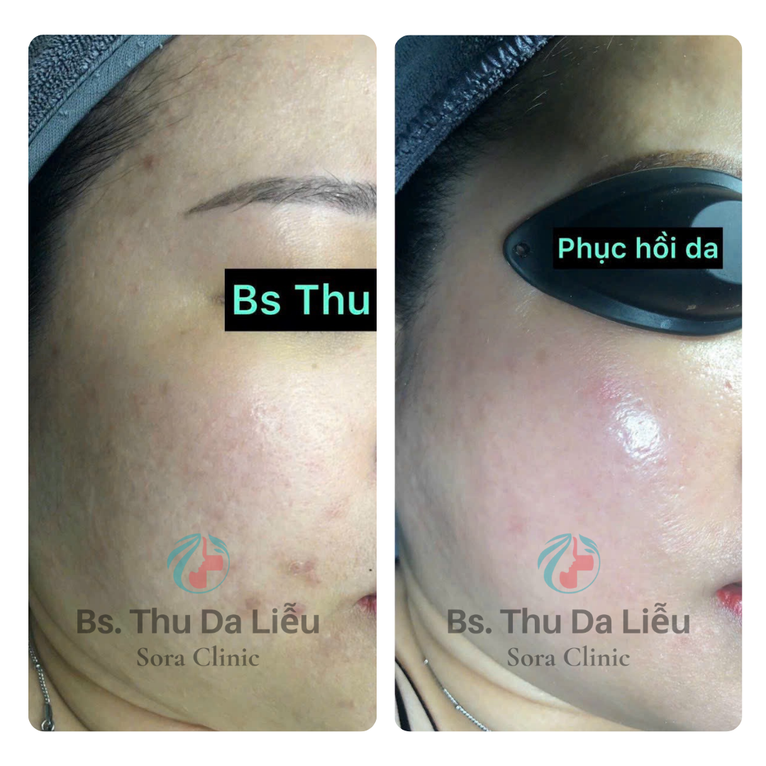 Thiết kế chưa có tên (1) (1)