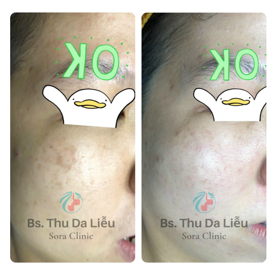 Thiết kế chưa có tên (2)