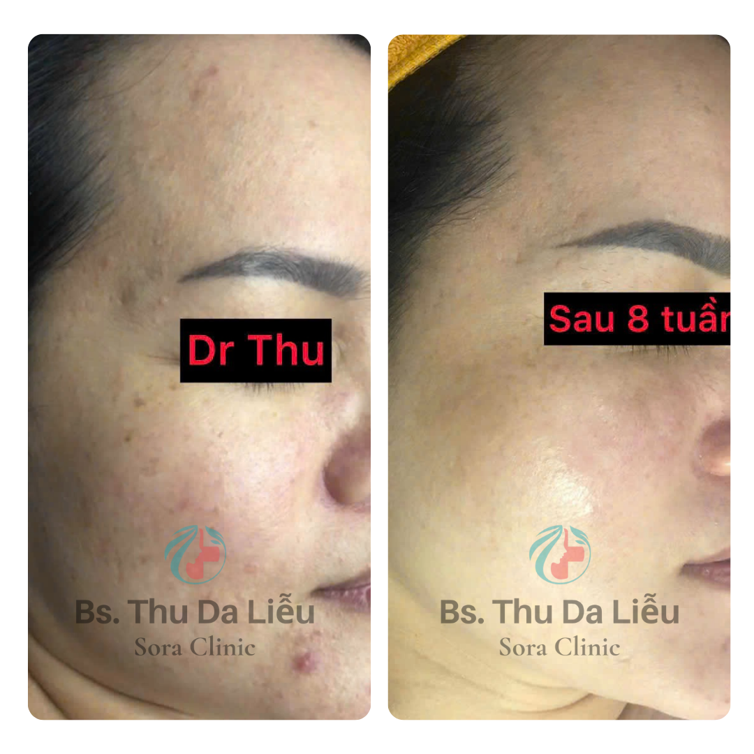 Thiết kế chưa có tên (3)