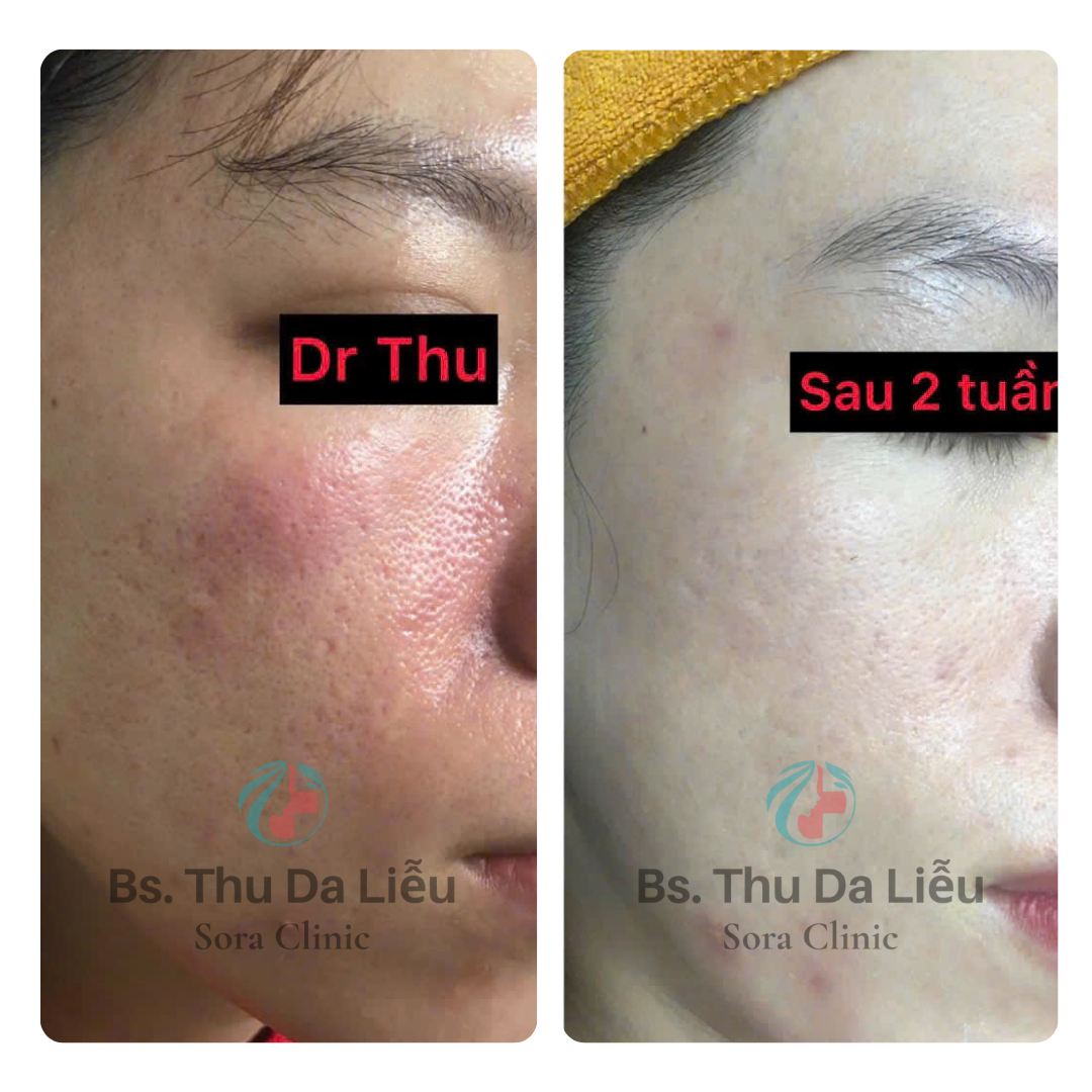 Thiết kế chưa có tên (4)