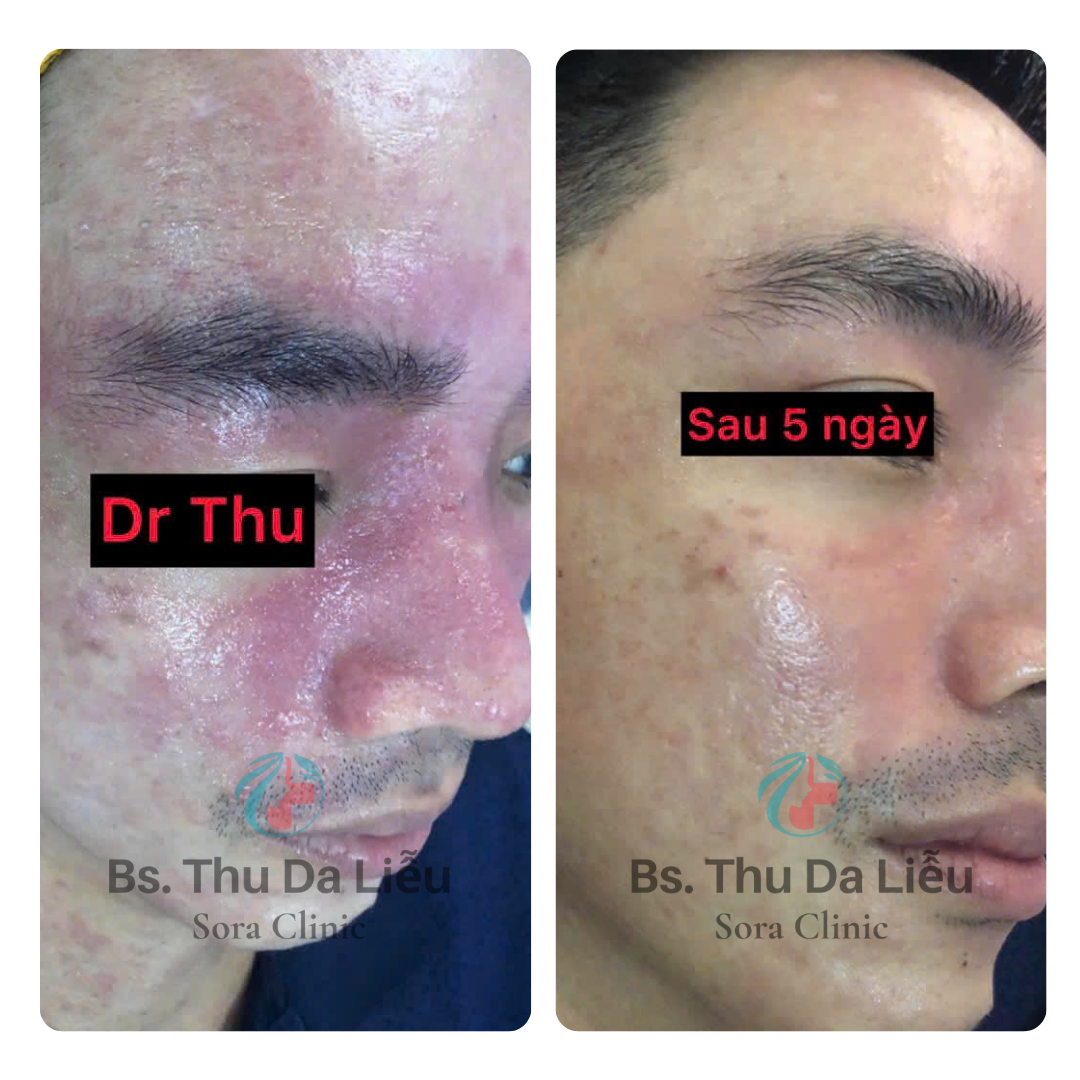 Thiết kế chưa có tên (5)