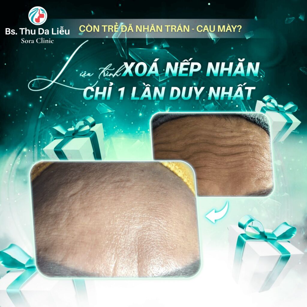 khách hàng 30+ vui vẻ kết quả hậu liệu trình