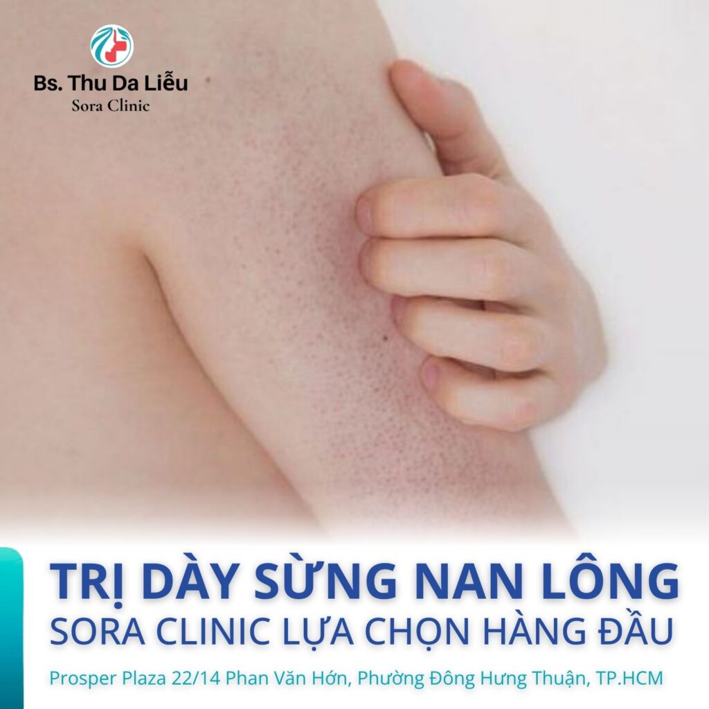 soi da đánh giá dày sừng nang lông tại Sora Clinic