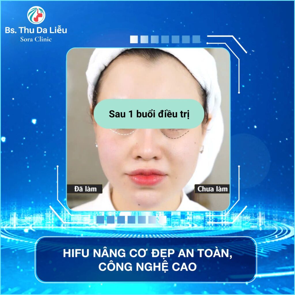 Công nghệ phục hồi da tầng sâu tại Sora Clinic