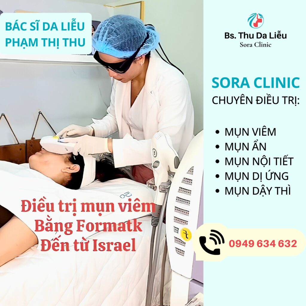 Điều trị mụn viêm an toàn giúp hạn chế thâm và sẹo