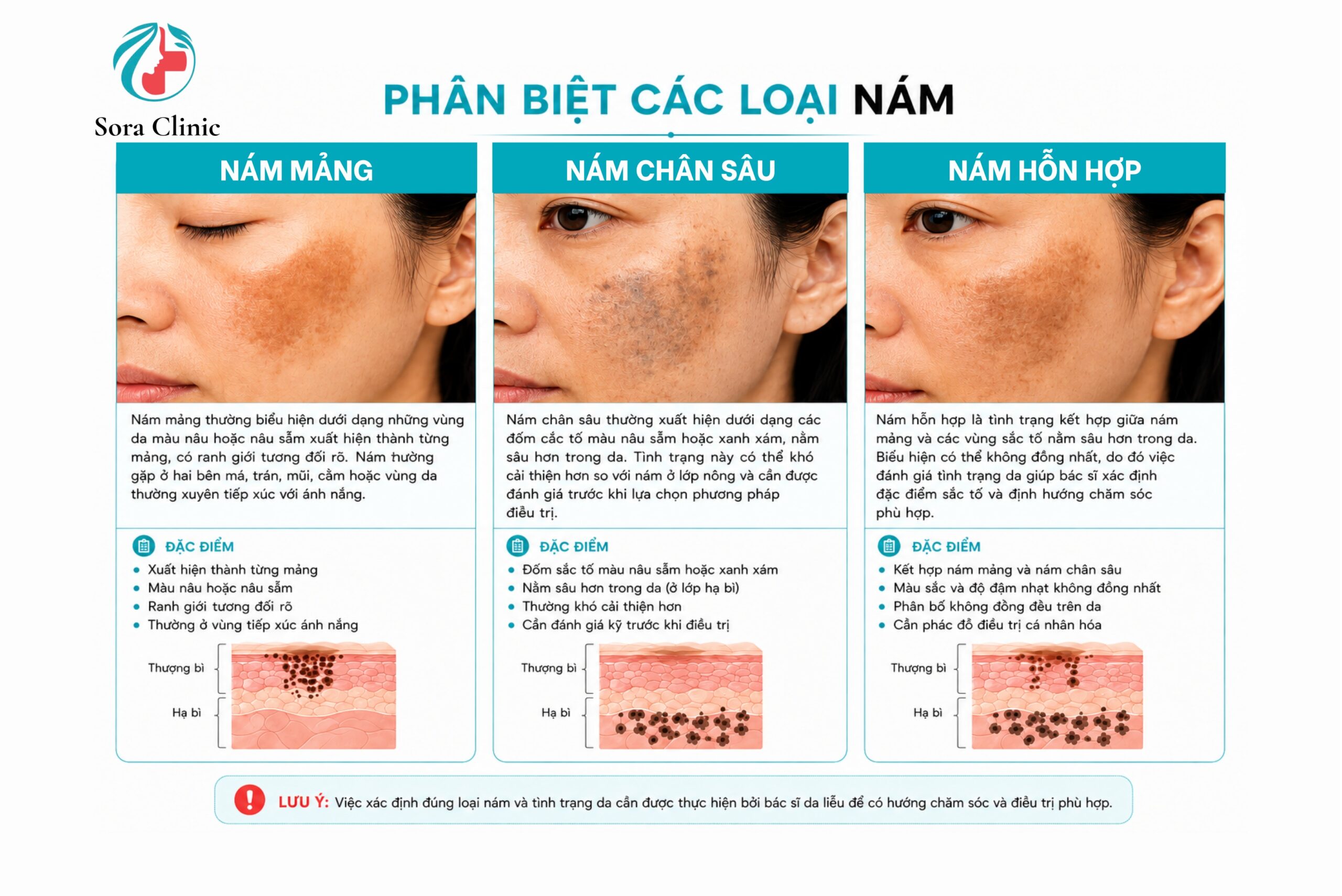 phan-biet-cac-loai-nam